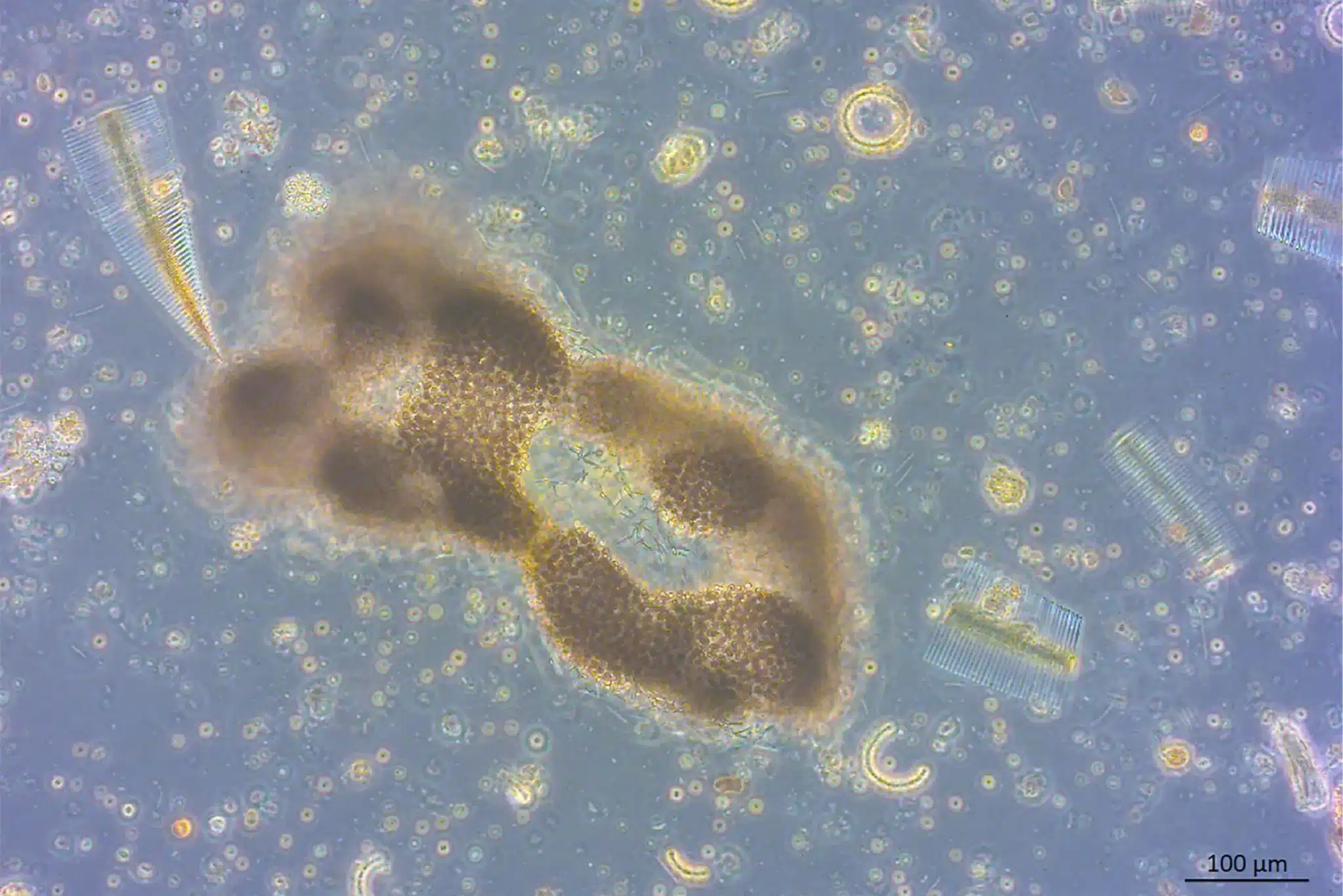 Analysis of Cyanotoxins and Cyanobacteria in Surface and Drinking Water